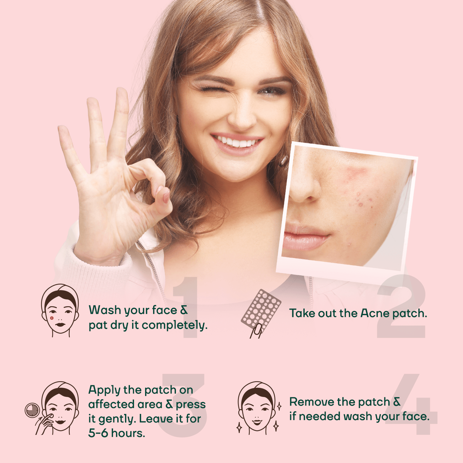 Acne Pimple Patch 72 || Acne Pimple Patch - Unisex 36 For FREE