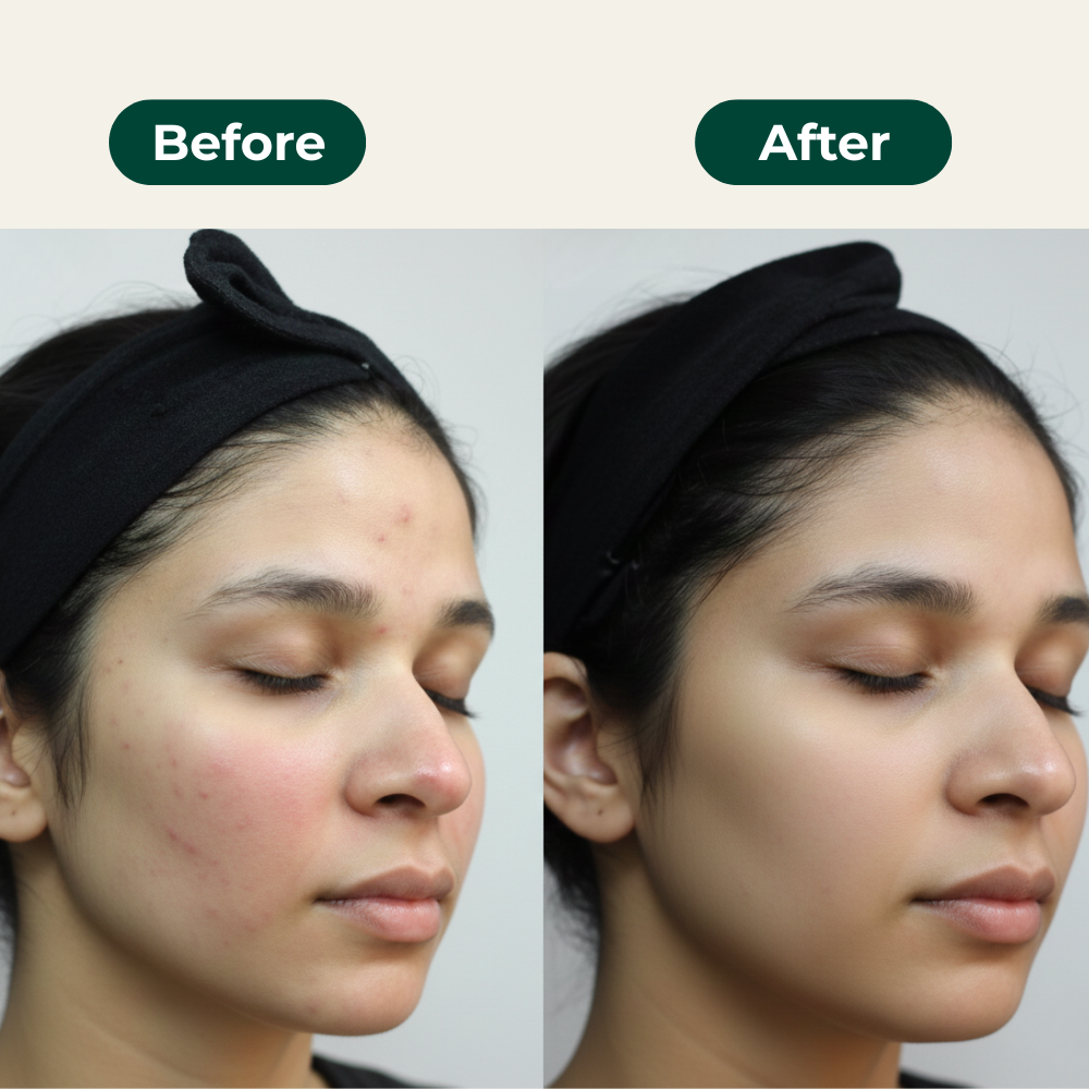 1 on 1 Skin Consultation